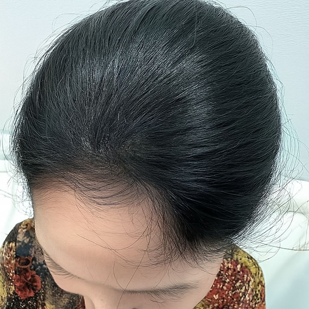 After Image